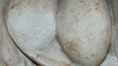 The Testicles of European Greek Statues